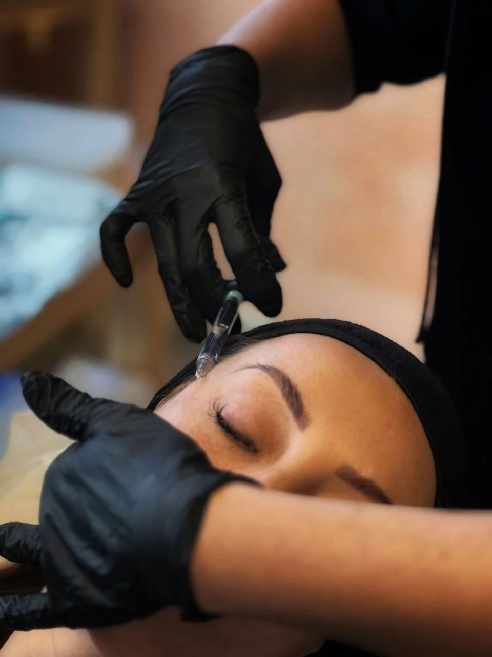 Nurse Rachel administering cheek filler at Refined Medical Aesthetics, Seaton Delaval